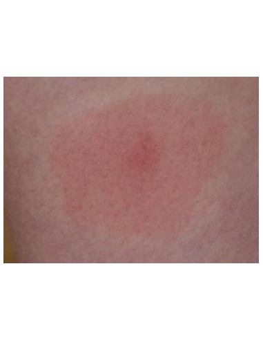 Riem Ti-Tox  Moustiques - Starter Flacon Liquide